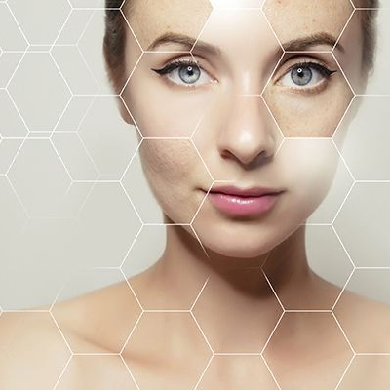 protect-collagen-in-skin